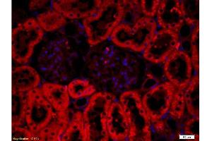 Formalin-fixed and paraffin embedded: rat kidney tissue labeled with Anti-CRF/CRH Polyclonal Antibody , Unconjugated at 1:200, followed by conjugation to the secondary antibody was Goat Anti-Rabbit IgG, PE conjugated -PE) at 1:200 for 40 minutes at 37°C DAPI(5ug/ml, blue) was used to stain the cell nuclei (CRH 抗体  (AA 145-185))