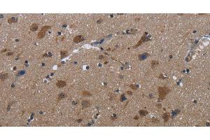 Immunohistochemistry of paraffin-embedded Human brain tissue using LETMD1 Polyclonal Antibody at dilution 1:30 (LETMD1 抗体)