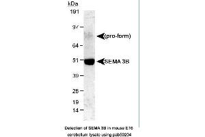 Image no. 1 for anti-Sema Domain, Immunoglobulin Domain (Ig), Short Basic Domain, Secreted, (Semaphorin) 3B (SEMA3B) (AA 100-200) antibody (ABIN363513) (SEMA3B 抗体  (AA 100-200))