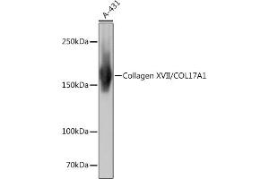 Western blot analysis of extracts of A-431 cells, using Collagen XVII/COL17 Rabbit mAb (ABIN7266467) at 1:1000 dilution. (COL17A1 抗体)
