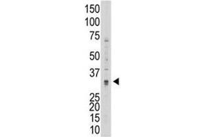 Western blot testing of MMP7 antibody and 293 cell lysate (MMP7 抗体  (AA 117-146))