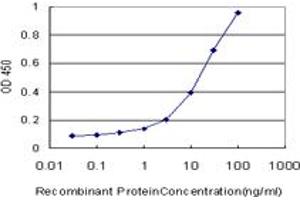 Detection limit for recombinant GST tagged SGCB is approximately 0. (SGCB 抗体  (AA 1-318))