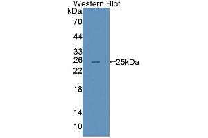Western Blotting (WB) image for anti-ATP-Binding Cassette, Sub-Family A (ABC1), Member 8 (ABCA8) (AA 1263-1456) antibody (ABIN5013176)