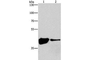 Western Blot analysis of 293T and Human fetal brain tissue using MAPK11 Polyclonal Antibody at dilution of 1:200