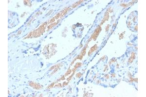 Formalin-fixed, paraffin-embedded human Pancreas stained with Spectrin alpha 1 Rabbit Recombinant Monoclonal Antibody (SPTA1/2939R). (Recombinant SPTA1 抗体  (AA 356-475))
