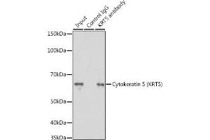 Immunoprecipitation analysis of 200 μg extracts of A-431 cells using 3 μg Cytokeratin 5 (Cytokeratin 5 (KRT5)) antibody (ABIN3016404, ABIN3016405, ABIN3016406 and ABIN6219743). (Cytokeratin 5 抗体)