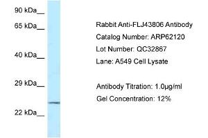 Western Blotting (WB) image for anti-Kazrin (KAZ) (C-Term) antibody (ABIN2774334) (Kazrin 抗体  (C-Term))