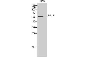 Western Blotting (WB) image for anti-Tripartite Motif Containing 38 (TRIM38) (Internal Region) antibody (ABIN3177285) (TRIM38 抗体  (Internal Region))