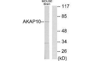 Western blot analysis of extracts from mouse brain cells, using AKAP10 antibody. (AKAP10 抗体  (N-Term))