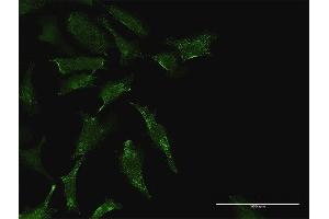 Immunofluorescence of purified MaxPab antibody to TEX264 on HeLa cell. (TEX264 抗体  (AA 1-313))