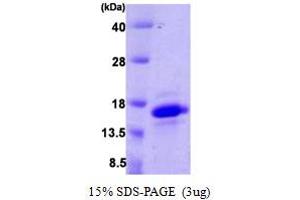 SDS-PAGE (SDS) image for Vesicle-Associated Membrane Protein 4 (VAMP4) (AA 1-115) protein (His tag) (ABIN666784)