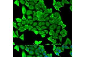 Immunofluorescence analysis of U2OS cells using MYH1 Polyclonal Antibody (MYH1 抗体)