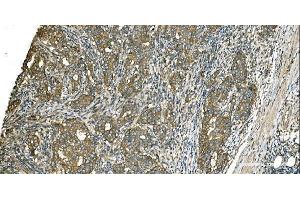 IHC analysis of Aspartate Aminotransferase/GOT1 using anti-Aspartate Aminotransferase/GOT1 antibody (ABIN7601883).