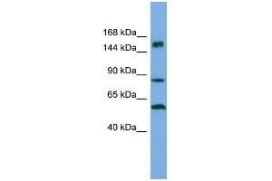 Host:  Rabbit  Target Name:  HERC3  Sample Type:  ACHN Whole Cell lysates  Antibody Dilution:  1.