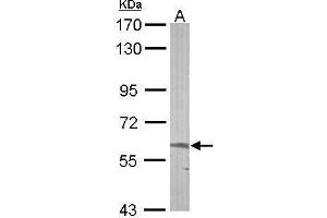 WB Image Sample (50 ug of whole cell lysate) A: mouse liver 7. (ALAS2 抗体  (Center))