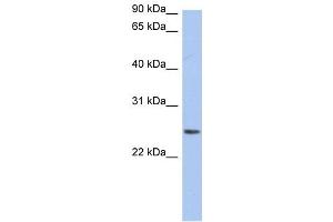 Neurensin 2 antibody used at 1 ug/ml to detect target protein. (NRSN2 抗体  (Middle Region))