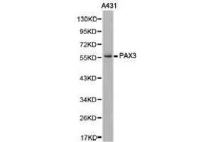 Western Blotting (WB) image for anti-Paired Box 3 (PAX3) antibody (ABIN1874047) (Paired Box 3 抗体)