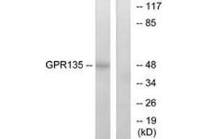 Western blot analysis of extracts from NIH-3T3 cells, using GPR135 Antibody. (GPR135 抗体  (AA 371-420))