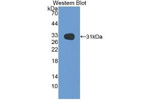 Western blot analysis of recombinant Rat MEP1b. (Meprin B 抗体  (AA 433-679))