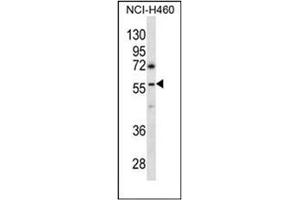 Western blot analysis of GBRR3 Antibody (N-term) in NCI-H460 cell line lysates (35ug/lane). (GBRR3 抗体  (N-Term))