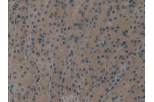 DAB staining on IHC-P; Samples: Rat Stomach Tissue (EIF2AK2 抗体  (AA 279-506))