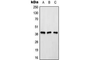 Western Blotting (WB) image for anti-ATPase, H+ Transporting, Lysosomal Accessory Protein 2 (ATP6AP2) (Center) antibody (ABIN7297736)