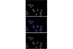 Immunofluorescent staining of mouse NIH3T3 cell line with antibody followed by an anti-rabbit antibody conjugated to Alexa488 (top). (HIST1H3A 抗体  (3meLys27))