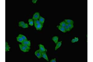 Immunofluorescent analysis of HepG2 cells using ABIN7168003 at dilution of 1:100 and Alexa Fluor 488-congugated AffiniPure Goat Anti-Rabbit IgG(H+L) (ROCK2 抗体  (AA 1109-1388))