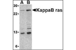 Western blot analysis of KappaB ras in 293 cell lysate with this product at (A) 2 and (B) 4 μg/ml. (NKIRAS1 抗体  (Center))