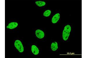 Immunofluorescence of monoclonal antibody to CDKL1 on HeLa cell. (CDKL1 抗体  (AA 259-358))