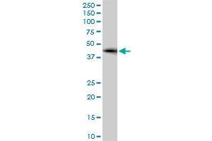 ZNF265 monoclonal antibody (M02), clone 2A11. (ZNF265 抗体  (AA 1-106))