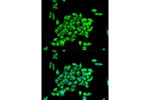 Immunofluorescence analysis of HeLa cell using TRAP1 antibody. (TRAP1 抗体)
