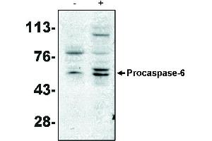Western blot analysis using caspase-6 antibody on MCF-7 cells negative (-) and positive (+) for caspase-3 after treatment for 48 hours with thapsigargin. (Caspase 6 抗体)