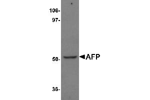 Western Blotting (WB) image for anti-alpha-Fetoprotein (AFP) (N-Term) antibody (ABIN1031219) (alpha Fetoprotein 抗体  (N-Term))