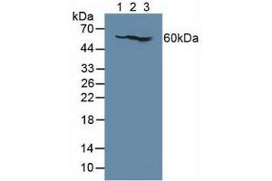 Figure. (IL7R 抗体  (AA 173-260))