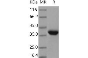 Western Blotting (WB) image for Epithelial Cell Adhesion Molecule (EPCAM) protein (His tag) (ABIN7321140)