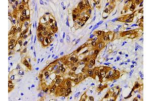 Immunohistochemistry (IHC) image for anti-Cofilin 1 (CFL1) (pSer3) antibody (ABIN6255180)