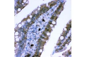 IHC analysis of Plectin using anti-Plectin antibody (ABIN3043900).