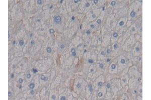 Detection of SDC1 in Human Liver Tissue using Polyclonal Antibody to Syndecan 1 (SDC1) (Syndecan 1 抗体  (AA 23-253))