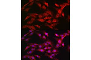 Immunofluorescence (IF) image for anti-Karyopherin (Importin) beta 1 (KPNB1) (AA 250-350) antibody (ABIN6142997)