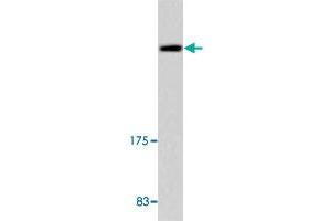 Western blot analysis of A-549 cell lysate with UBR5 polyclonal antibody . (UBR5 抗体)