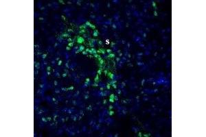 Immunohistochemistry (IHC) image for anti-SLIT and NTRK-Like Family, Member 2 (SLITRK2) (AA 301-315), (Extracellular) antibody (ABIN7043630)