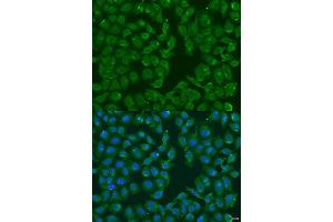 Immunofluorescence analysis of U2OS cells using MSRB3 antibody. (MSRB3 抗体  (AA 1-185))