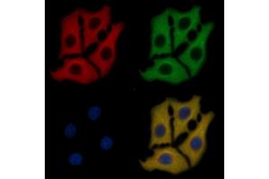 DDR1 Mouse Monoclonal Antibody staining HepG2 cells by IF/ICC. (DDR1 抗体  (C-Term))