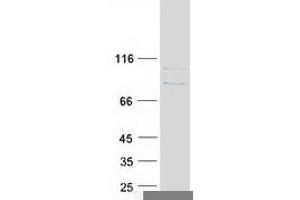 Validation with Western Blot