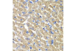 Immunohistochemistry of paraffin-embedded mouse heart using FIBP antibody at dilution of 1:100 (x40 lens). (FIBP 抗体)