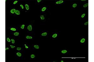 Immunofluorescence of purified MaxPab antibody to RALYL on HeLa cell. (RALYL 抗体  (AA 1-291))