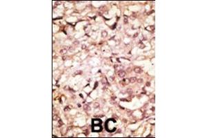 Immunohistochemistry (Paraffin-embedded Sections) (IHC (p)) image for anti-Angiotensin I Converting Enzyme 2 (ACE2) (AA 773-805), (C-Term) antibody (ABIN390049)
