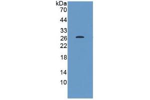 WB of Protein Standard: different control antibodies against Highly purified E. (HSP27 ELISA 试剂盒)