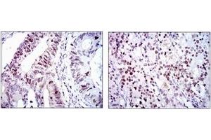 Immunohistochemistry (IHC) image for anti-Cyclin-Dependent Kinase 2 (CDK2) antibody (ABIN1106645) (CDK2 抗体)